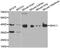 G Protein Subunit Alpha 11 antibody, A2731, ABclonal Technology, Western Blot image 