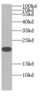 ADP Ribosylation Factor 5 antibody, FNab00534, FineTest, Western Blot image 