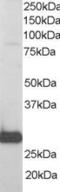 Ran-specific GTPase-activating protein antibody, EB06420, Everest Biotech, Western Blot image 