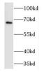 FMR1 Neighbor antibody, FNab03173, FineTest, Western Blot image 