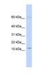 Keratin Associated Protein 8-1 antibody, orb325241, Biorbyt, Western Blot image 