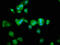 Transient Receptor Potential Cation Channel Subfamily V Member 2 antibody, CSB-PA897571LA01HU, Cusabio, Immunofluorescence image 