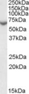 Steroid Sulfatase antibody, LS-C54545, Lifespan Biosciences, Western Blot image 