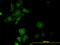Prolyl 3-Hydroxylase 1 antibody, LS-C133804, Lifespan Biosciences, Immunofluorescence image 