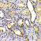 Kinesin Family Member 2C antibody, A5449, ABclonal Technology, Immunohistochemistry paraffin image 