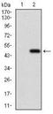Activated Leukocyte Cell Adhesion Molecule antibody, NBP2-37345, Novus Biologicals, Western Blot image 