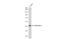 Pentraxin 3 antibody, GTX135596, GeneTex, Western Blot image 