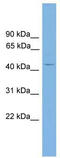 ALX Homeobox 4 antibody, TA341743, Origene, Western Blot image 