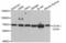 CD184 antibody, AHP2451, Bio-Rad (formerly AbD Serotec) , Western Blot image 