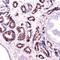 Alpha-Methylacyl-CoA Racemase antibody, NB120-12498, Novus Biologicals, Immunohistochemistry frozen image 