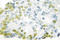 CCAAT Enhancer Binding Protein Alpha antibody, LS-C176665, Lifespan Biosciences, Immunohistochemistry paraffin image 