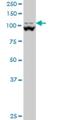Methylenetetrahydrofolate Dehydrogenase (NADP+ Dependent) 1 Like antibody, H00025902-M01, Novus Biologicals, Western Blot image 