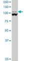 Methylenetetrahydrofolate Dehydrogenase (NADP+ Dependent) 1 Like antibody, H00025902-M01, Novus Biologicals, Western Blot image 