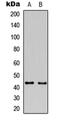 Growth Associated Protein 43 antibody, MBS8219452, MyBioSource, Western Blot image 