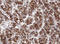 NADH:Ubiquinone Oxidoreductase Subunit B10 antibody, LS-C174197, Lifespan Biosciences, Immunohistochemistry paraffin image 