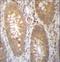 Dehydrogenase/Reductase 7B antibody, LS-C167402, Lifespan Biosciences, Immunohistochemistry paraffin image 