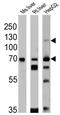 Sterol regulatory element-binding protein 2 antibody, GTX82865, GeneTex, Western Blot image 
