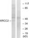 X-Ray Repair Cross Complementing 2 antibody, abx013255, Abbexa, Immunohistochemistry frozen image 