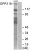 Adhesion G Protein-Coupled Receptor F5 antibody, A30800, Boster Biological Technology, Western Blot image 