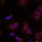 JunB Proto-Oncogene, AP-1 Transcription Factor Subunit antibody, GTX50105, GeneTex, Immunocytochemistry image 