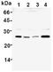 Glutathione S-Transferase Pi 1 antibody, ADI-MSA-101-E, Enzo Life Sciences, Western Blot image 