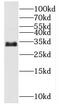 Myozenin 2 antibody, FNab05524, FineTest, Western Blot image 