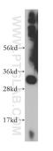 Solute Carrier Family 25 Member 45 antibody, 14160-1-AP, Proteintech Group, Western Blot image 