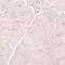 Oxysterol Binding Protein 2 antibody, HPA021514, Atlas Antibodies, Immunohistochemistry frozen image 