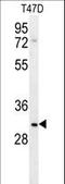 Leucine Rich Repeat Containing 52 antibody, LS-C165888, Lifespan Biosciences, Western Blot image 