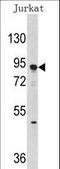 DNA Methyltransferase 3 Alpha antibody, LS-C96546, Lifespan Biosciences, Western Blot image 