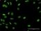 RALY RNA Binding Protein Like antibody, H00138046-B03P, Novus Biologicals, Immunofluorescence image 