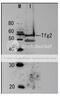 General Transcription Factor IIF Subunit 2 antibody, 62-019, BioAcademia Inc, Western Blot image 