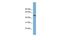 Actin Related Protein 3B antibody, GTX44914, GeneTex, Western Blot image 