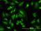 Serum/Glucocorticoid Regulated Kinase 1 antibody, H00006446-M01, Novus Biologicals, Immunocytochemistry image 