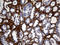 Transforming Growth Factor Beta Induced antibody, LS-C793903, Lifespan Biosciences, Immunohistochemistry paraffin image 