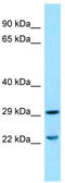 Solute Carrier Family 25 Member 10 antibody, TA331226, Origene, Western Blot image 
