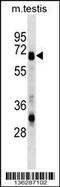 Asparagine Synthetase (Glutamine-Hydrolyzing) antibody, 58-811, ProSci, Western Blot image 