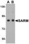 Sterile Alpha And TIR Motif Containing 1 antibody, MBS150071, MyBioSource, Western Blot image 