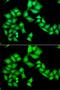 Aladin WD Repeat Nucleoporin antibody, GTX30014, GeneTex, Immunofluorescence image 