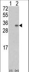 Vascular Endothelial Growth Factor B antibody, LS-C160515, Lifespan Biosciences, Western Blot image 
