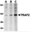 TNF receptor-associated factor 2 antibody, 3663, ProSci Inc, Western Blot image 