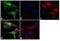 Calcium/Calmodulin Dependent Serine Protein Kinase antibody, GTX23383, GeneTex, Immunocytochemistry image 