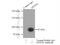 DExD-Box Helicase 50 antibody, 10358-1-AP, Proteintech Group, Immunoprecipitation image 