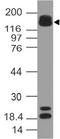 AT-Rich Interaction Domain 5B antibody, A02880, Boster Biological Technology, Western Blot image 