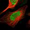 Transmembrane Protein 65 antibody, HPA025020, Atlas Antibodies, Immunofluorescence image 