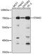 Signal Transducing Adaptor Molecule 2 antibody, A06533, Boster Biological Technology, Western Blot image 