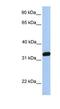 NFKB Inhibitor Interacting Ras Like 2 antibody, NBP1-58926, Novus Biologicals, Western Blot image 