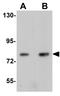 Anaphase Promoting Complex Subunit 5 antibody, GTX17060, GeneTex, Western Blot image 