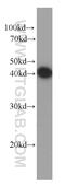 Pyruvate dehydrogenase E1 component subunit alpha, somatic form, mitochondrial antibody, 66119-1-Ig, Proteintech Group, Western Blot image 