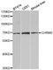 Cholinergic Receptor Muscarinic 5 antibody, PA5-76520, Invitrogen Antibodies, Western Blot image 